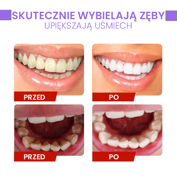 Korektor koloru zębów i serum do pielęgnacji szkliwa