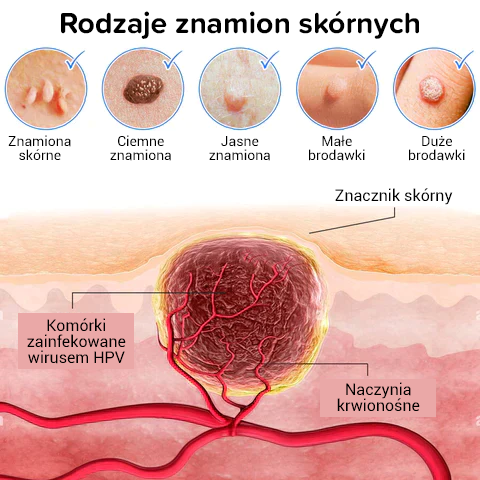 Kremy Prime na niedoskonałości skóry, znamiona i brodawki PREMIUM